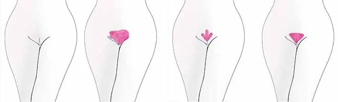 vagina