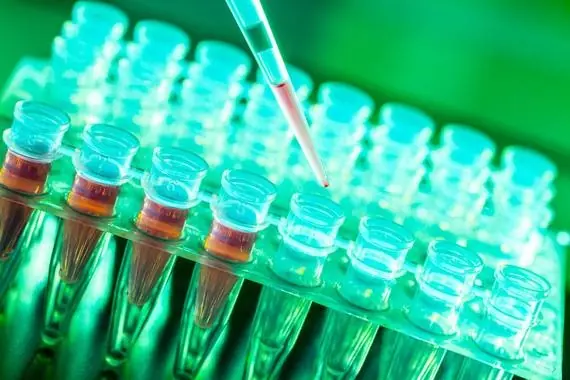 Liquido Inyectable ilumina celulas cancerigenas