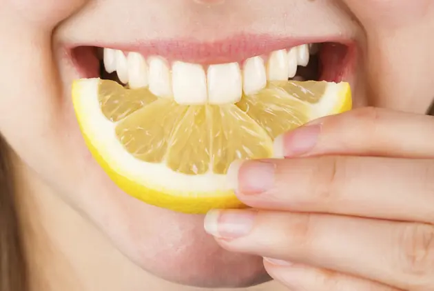 dientes