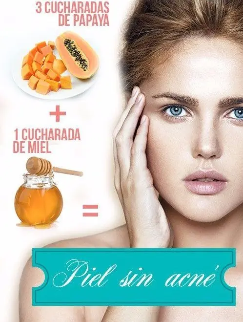 espinillas