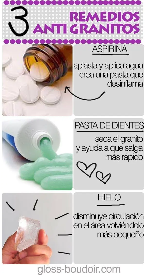 Tips para deshacerte del acné de una vez por todas
