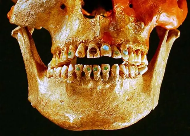 dientes