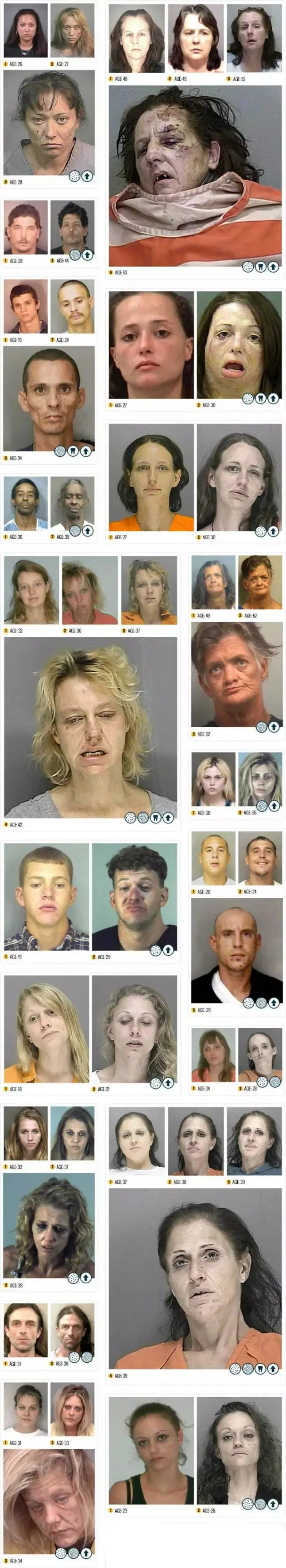 El Antes Y Después De Gente Que Ha Usado Drogas.