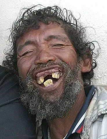 blanquear dientes