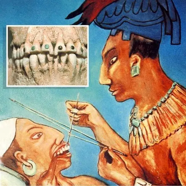 dientes