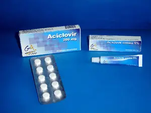 varicela