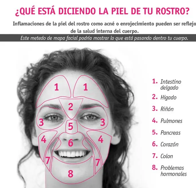 ¿Acné sin solución? Entra acá!