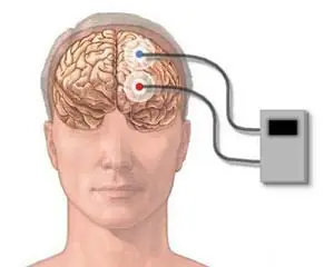 Control mental