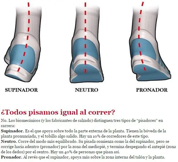 Veni Lince! Preguntas con Increíbles Respuestas!