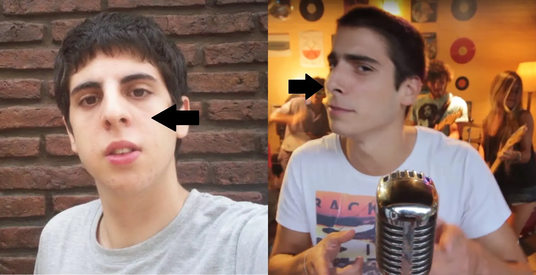 Pichi