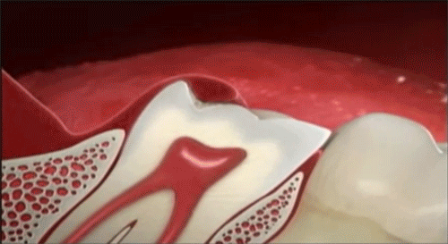 Consulta dental lo que necesitas saber