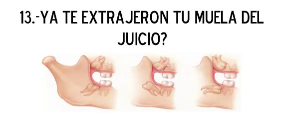 Caries
