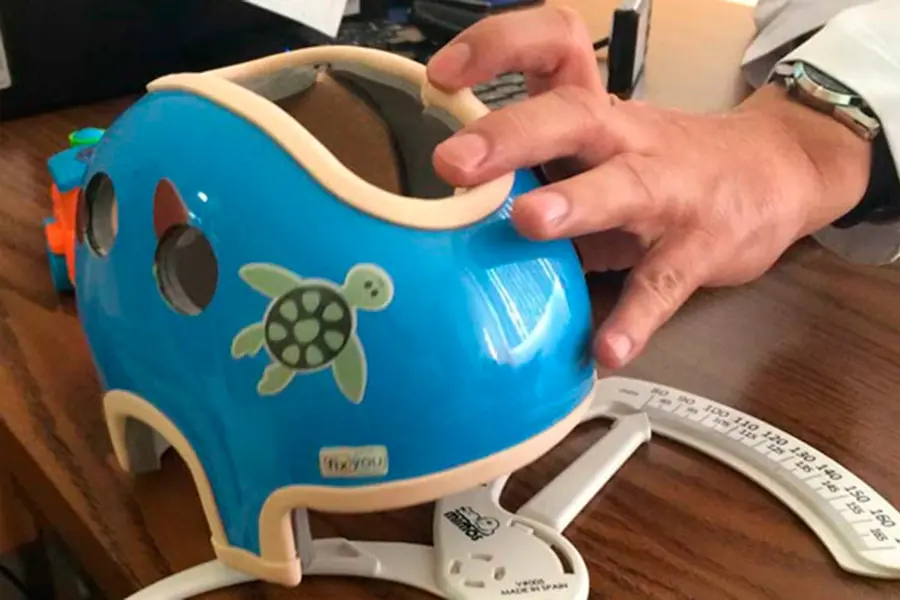 Casco ayuda a diagnosticar enfermedades neurodegenerativas