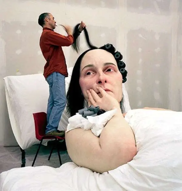 hipertiroidismo hipertiroidismo
