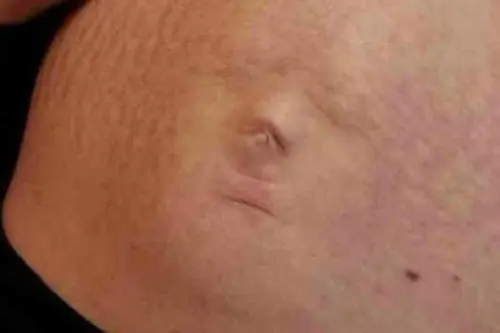 vientre vientre