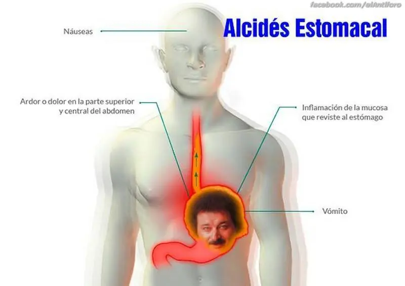 imagenes