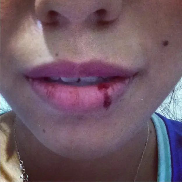 labios secos
