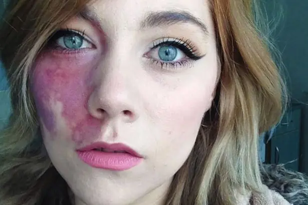 Le dijeron que era muy fea, Mira como les Cerro la Boca