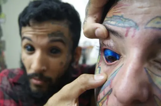 globo ocular