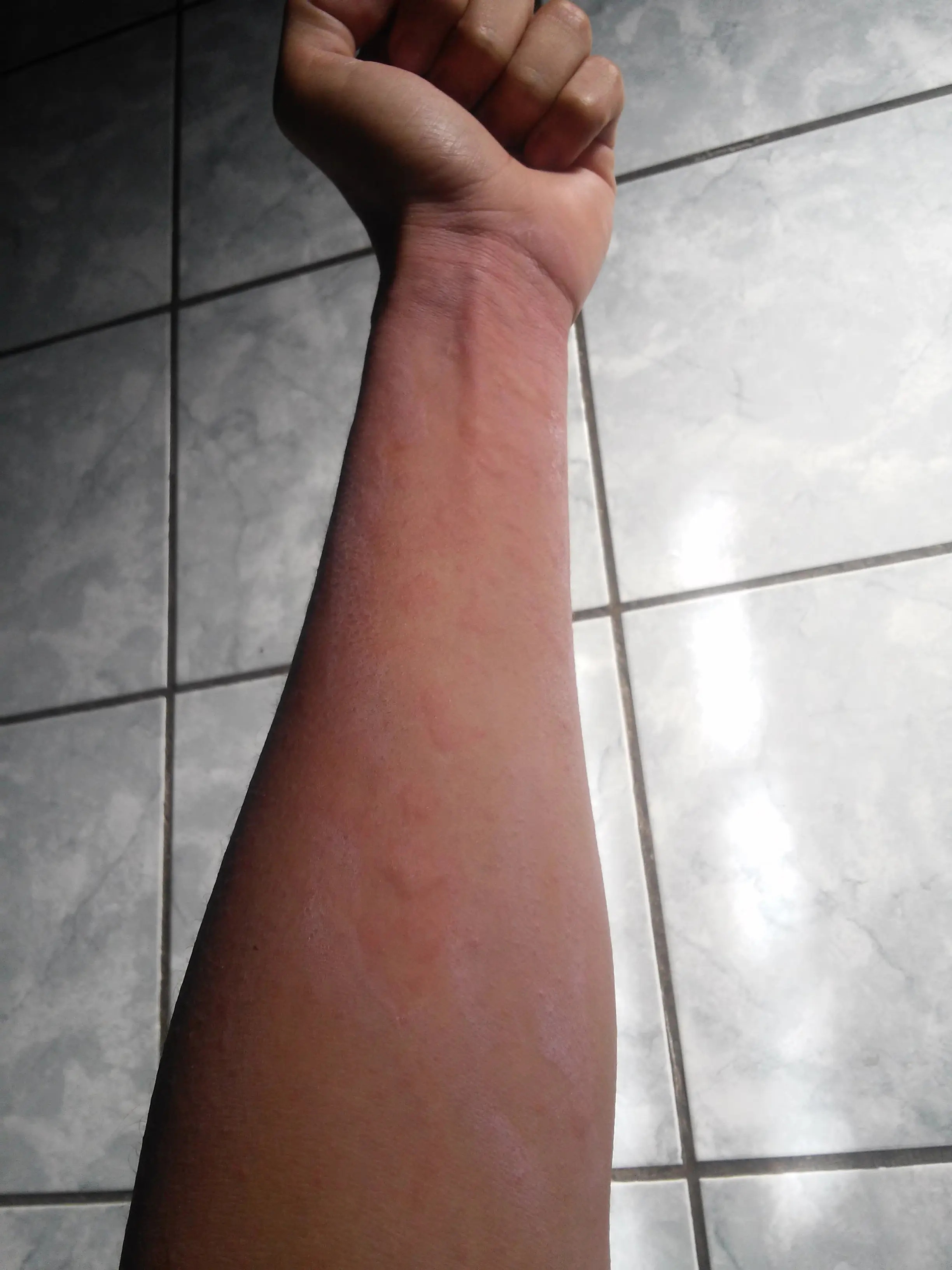 aedes aegypti