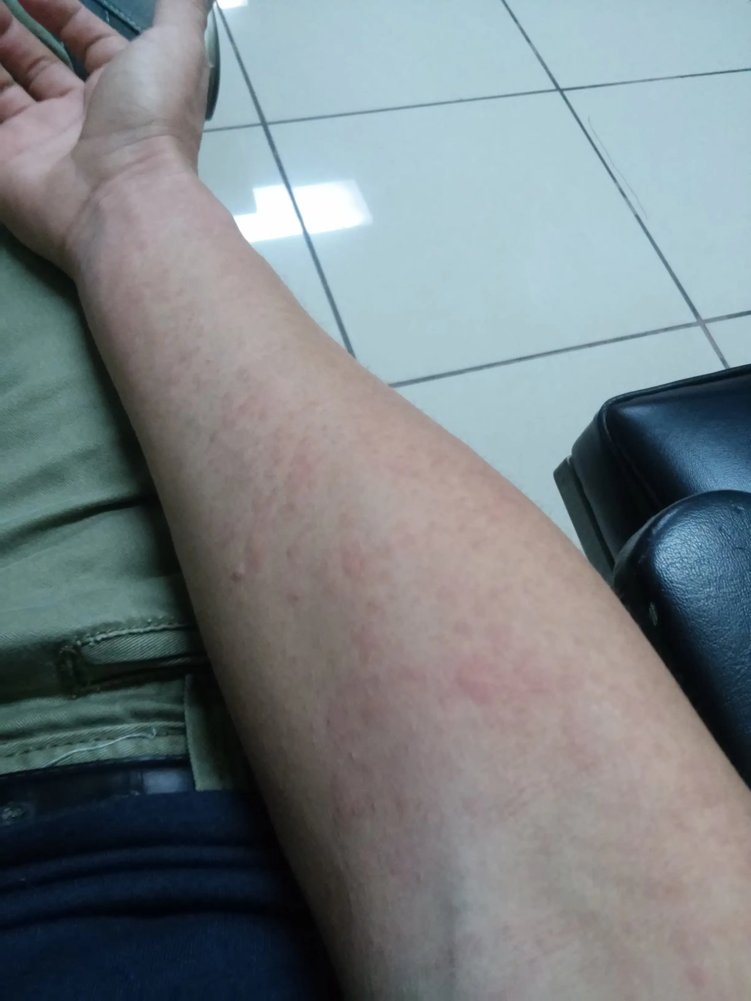 aedes aegypti