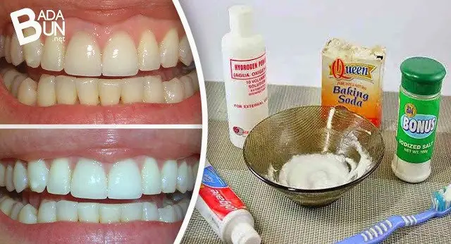 dientes