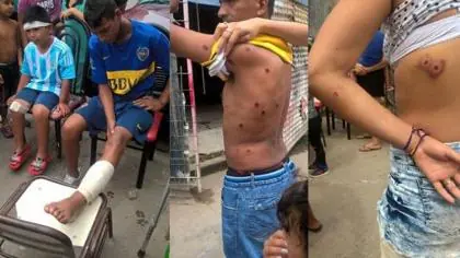 Algo más sobre la represión a la Murga en la 1.11.14