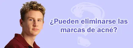 Tenes granos? pasate por este post! Tenes granos? pasate por este post!