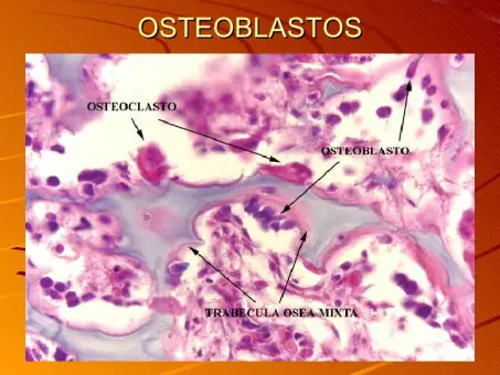 osteoporosis osteoporosis