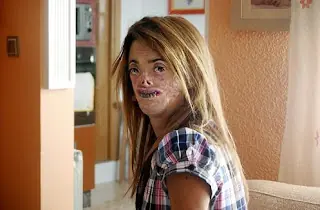 sindrome