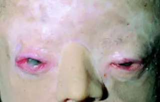 anomalias
