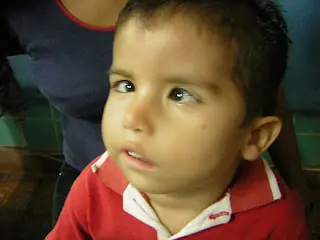 sindrome