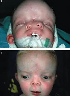 Entra mostro! y conoce 15 anomalías medicas mas raras