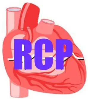 Aprende a hacer RCP (Reanimación cardiopulmonar)