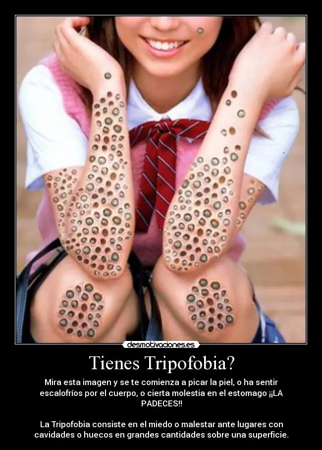 Tenes Tripofobia? No lo sabias? Enterate.
