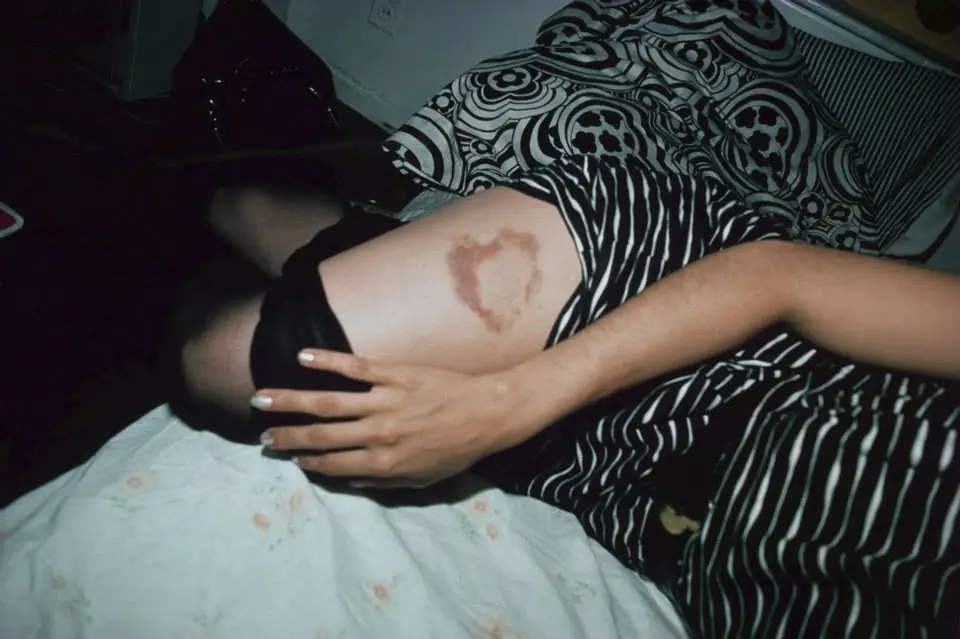fotos