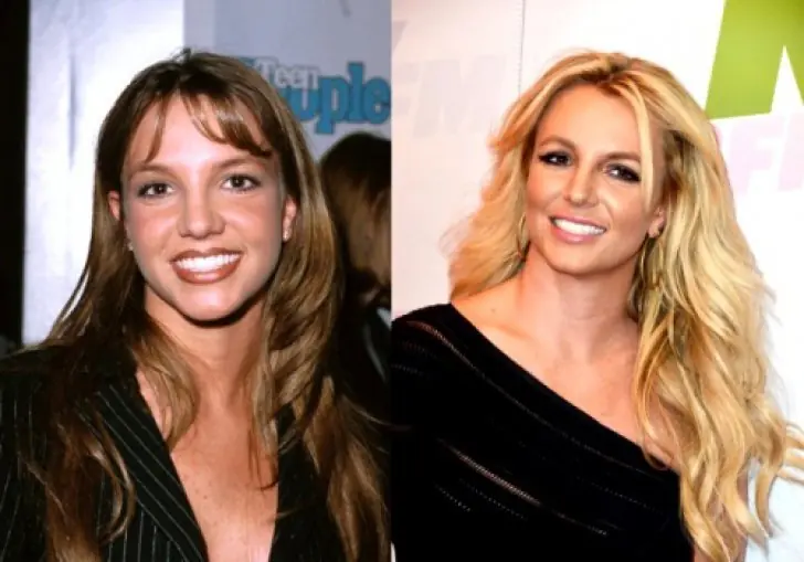 Cirugía plástica de los famosos: el antes y el después