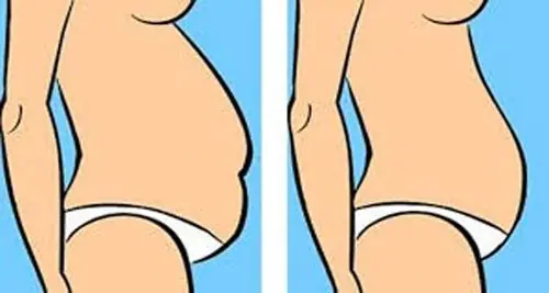 Qué tipo de barriga tienes y cómo reducirla aquí te explico