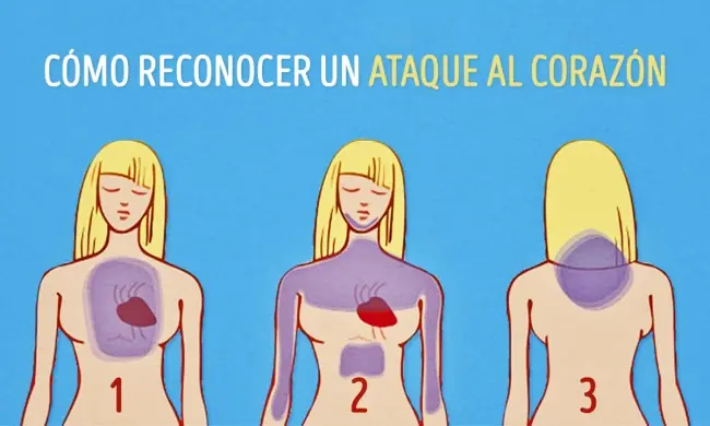 ataque al corazon ataque al corazon