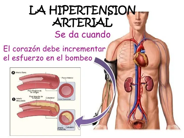 Licopeno, glutatión, antioxidante,anticamcerige en el tomate
