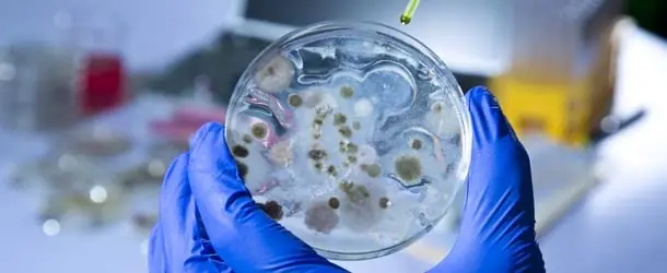 infecciones infecciones