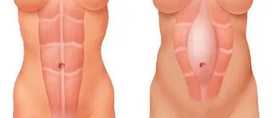 mujer mujer