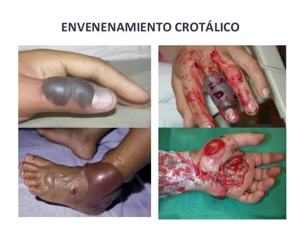 donacion
