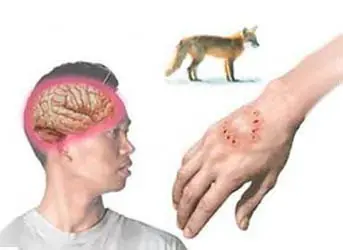 fobias