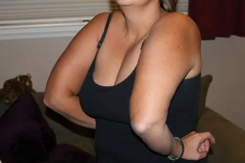 fotos