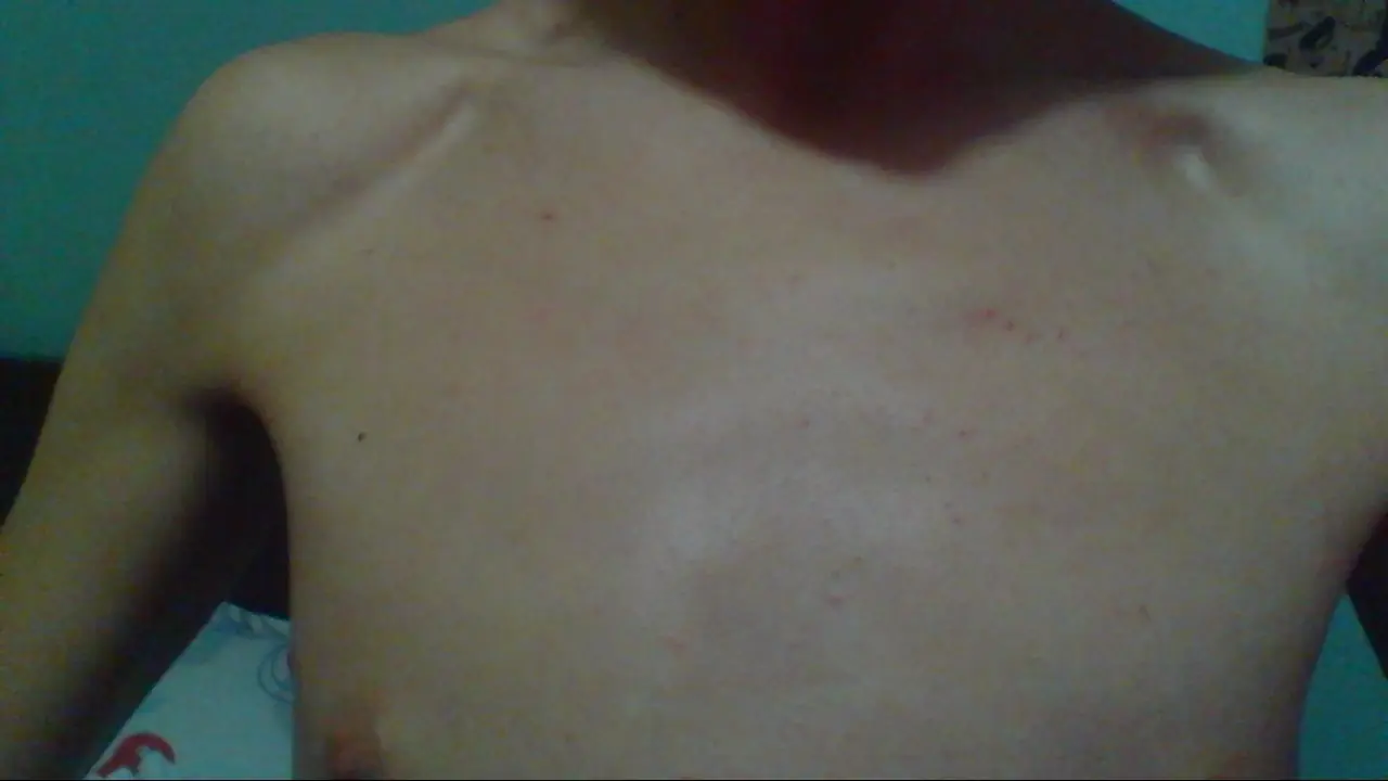 acne solucion definitiva