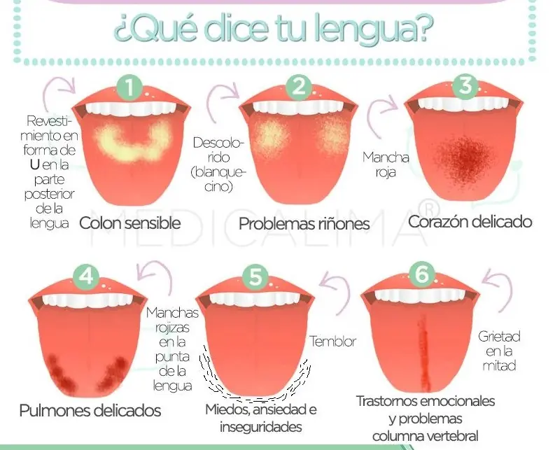 nutricionales