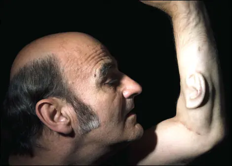 arte