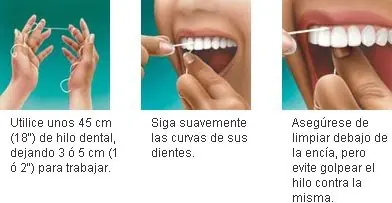 Dental Dental