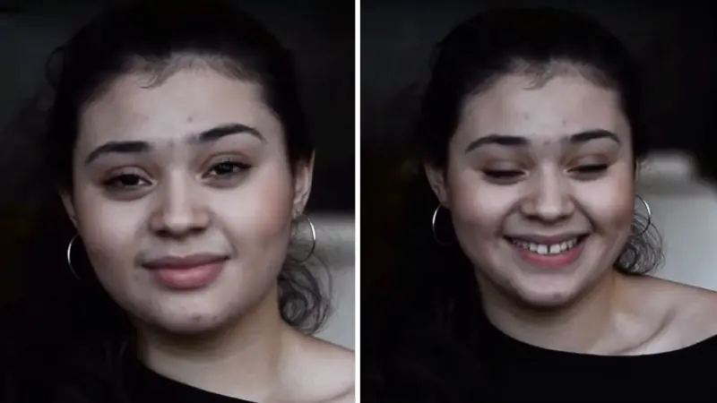 sonrisa